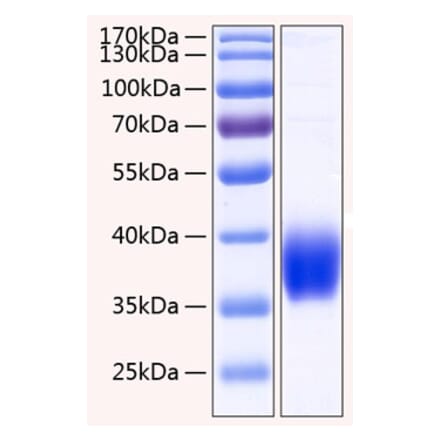 SDS-PAGE - Recombinant Human CA12 Protein (C-terminal His Tag) (A330180) - Antibodies.com