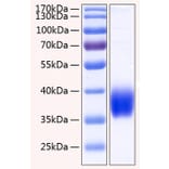 SDS-PAGE - Recombinant Human CA12 Protein (C-terminal His Tag) (A330180) - Antibodies.com