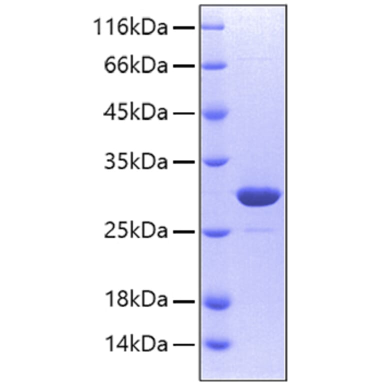 SDS-PAGE - Recombinant Human CA2 Protein (A330181) - Antibodies.com