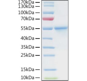SDS-PAGE - Recombinant Human CA9 Protein (C-terminal His and Avi Tag) (A330183) - Antibodies.com