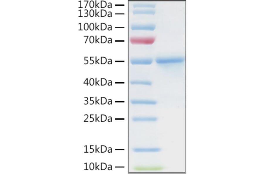 SDS-PAGE - Recombinant Human CA9 Protein (C-terminal His and Avi Tag) (A330183) - Antibodies.com