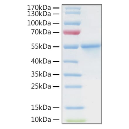 SDS-PAGE - Recombinant Human CA9 Protein (C-terminal His and Avi Tag) (A330183) - Antibodies.com