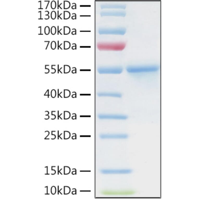 SDS-PAGE - Recombinant Human CA9 Protein (C-terminal His and Avi Tag) (A330183) - Antibodies.com