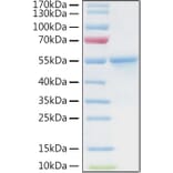 SDS-PAGE - Recombinant Human CA9 Protein (C-terminal His and Avi Tag) (A330183) - Antibodies.com