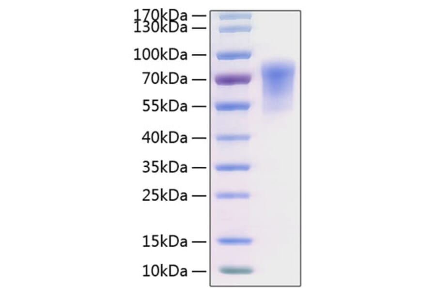 SDS-PAGE - Recombinant Human CADM1 Protein (C-terminal His Tag) (A330184) - Antibodies.com