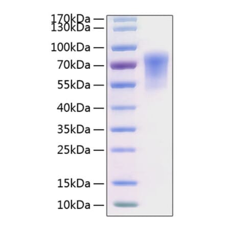 SDS-PAGE - Recombinant Human CADM1 Protein (C-terminal His Tag) (A330184) - Antibodies.com