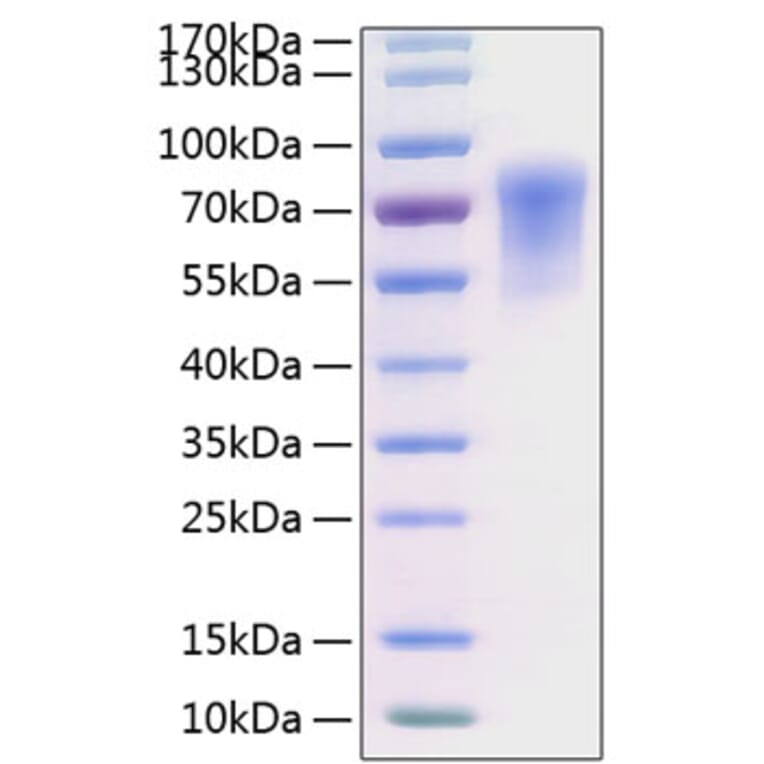 SDS-PAGE - Recombinant Human CADM1 Protein (C-terminal His Tag) (A330184) - Antibodies.com