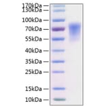 SDS-PAGE - Recombinant Human CADM1 Protein (C-terminal His Tag) (A330184) - Antibodies.com