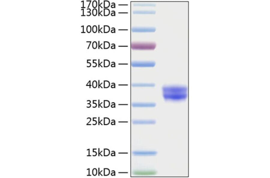 SDS-PAGE - Recombinant Human CADM3 Protein (C-terminal His Tag) (A330185) - Antibodies.com