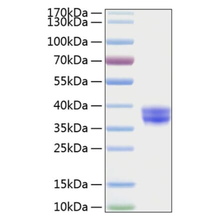 SDS-PAGE - Recombinant Human CADM3 Protein (C-terminal His Tag) (A330185) - Antibodies.com