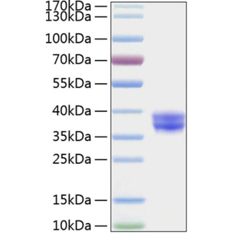 SDS-PAGE - Recombinant Human CADM3 Protein (C-terminal His Tag) (A330185) - Antibodies.com