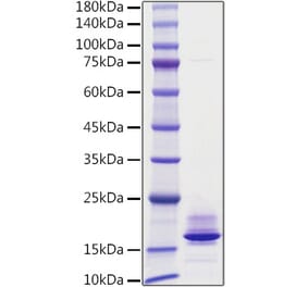 SDS-PAGE - Recombinant Human Calcitonin Protein (C-terminal His Tag) (A330186) - Antibodies.com