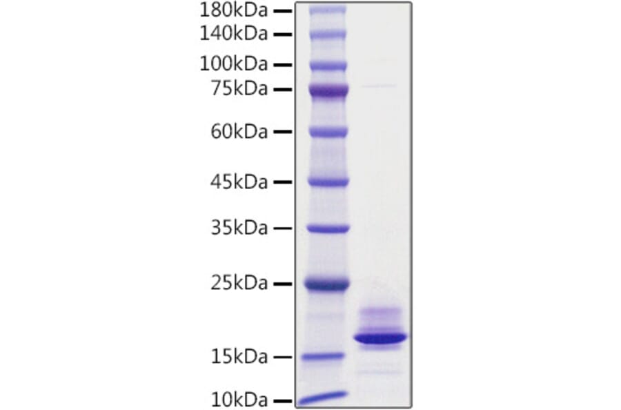 SDS-PAGE - Recombinant Human Calcitonin Protein (C-terminal His Tag) (A330186) - Antibodies.com