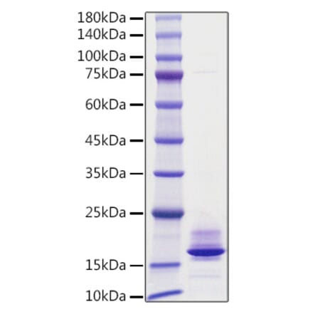 SDS-PAGE - Recombinant Human Calcitonin Protein (C-terminal His Tag) (A330186) - Antibodies.com