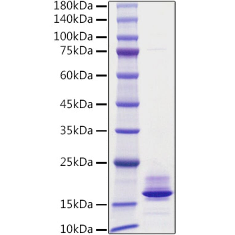 SDS-PAGE - Recombinant Human Calcitonin Protein (C-terminal His Tag) (A330186) - Antibodies.com