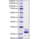 SDS-PAGE - Recombinant Human Calcitonin Protein (C-terminal His Tag) (A330186) - Antibodies.com