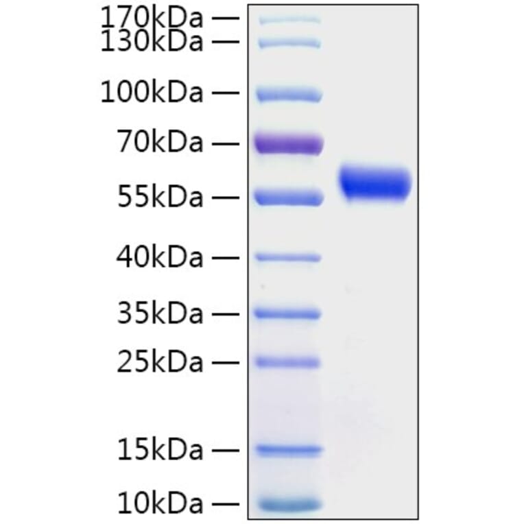 SDS-PAGE - Recombinant Human Calreticulin Protein (C-terminal His Tag) (A330187) - Antibodies.com