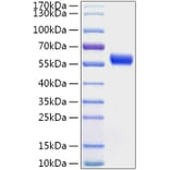 SDS-PAGE - Recombinant Human Calreticulin Protein (C-terminal His Tag) (A330187) - Antibodies.com
