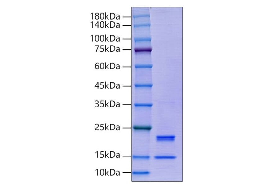 SDS-PAGE - Recombinant Human Caspase-7 Protein (C-terminal His Tag) (A330189) - Antibodies.com