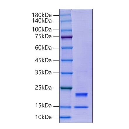 SDS-PAGE - Recombinant Human Caspase-7 Protein (C-terminal His Tag) (A330189) - Antibodies.com