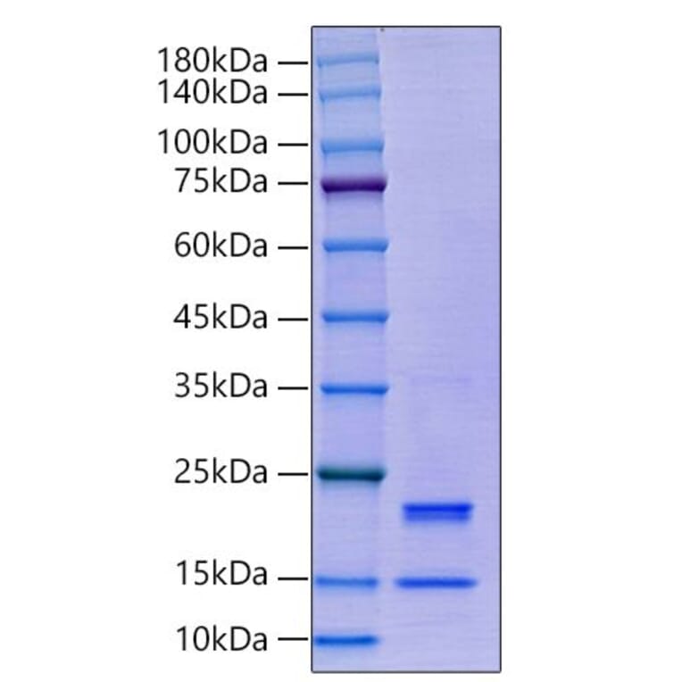 SDS-PAGE - Recombinant Human Caspase-7 Protein (C-terminal His Tag) (A330189) - Antibodies.com