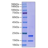 SDS-PAGE - Recombinant Human Caspase-7 Protein (C-terminal His Tag) (A330189) - Antibodies.com