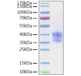 SDS-PAGE - Recombinant Mouse Cathepsin B Protein (C-terminal His Tag) (A330190) - Antibodies.com