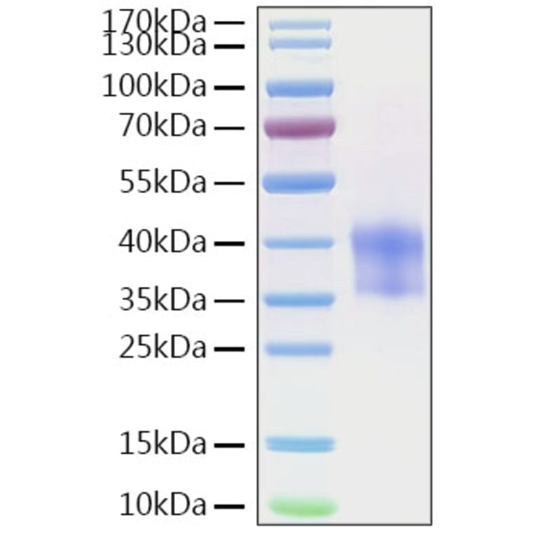 SDS-PAGE - Recombinant Mouse Cathepsin B Protein (C-terminal His Tag) (A330190) - Antibodies.com