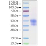 SDS-PAGE - Recombinant Mouse Cathepsin B Protein (C-terminal His Tag) (A330190) - Antibodies.com