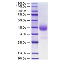 SDS-PAGE - Recombinant Human Cathepsin B Protein (C-terminal His Tag) (A330191) - Antibodies.com