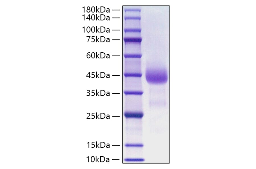 SDS-PAGE - Recombinant Human Cathepsin B Protein (C-terminal His Tag) (A330191) - Antibodies.com