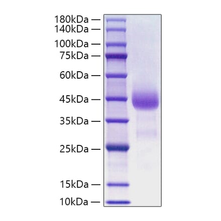 SDS-PAGE - Recombinant Human Cathepsin B Protein (C-terminal His Tag) (A330191) - Antibodies.com