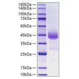 SDS-PAGE - Recombinant Human Cathepsin B Protein (C-terminal His Tag) (A330191) - Antibodies.com