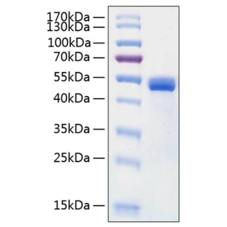 SDS-PAGE - Recombinant Human Cathepsin D Protein (C-terminal His Tag) (A330192) - Antibodies.com