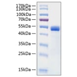 SDS-PAGE - Recombinant Human Cathepsin D Protein (C-terminal His Tag) (A330192) - Antibodies.com