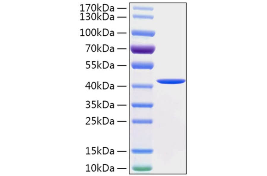 SDS-PAGE - Recombinant Human Cathepsin E Protein (C-terminal His Tag) (A330193) - Antibodies.com