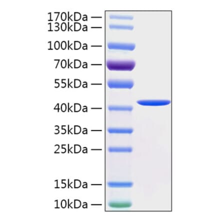 SDS-PAGE - Recombinant Human Cathepsin E Protein (C-terminal His Tag) (A330193) - Antibodies.com