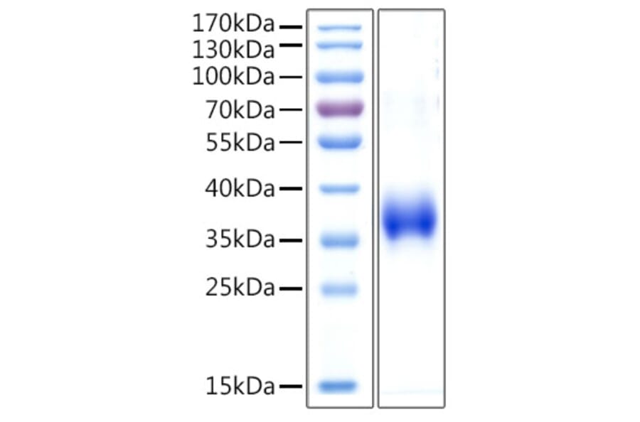 SDS-PAGE - Recombinant Human Cathepsin L Protein (C-terminal His Tag) (A330194) - Antibodies.com