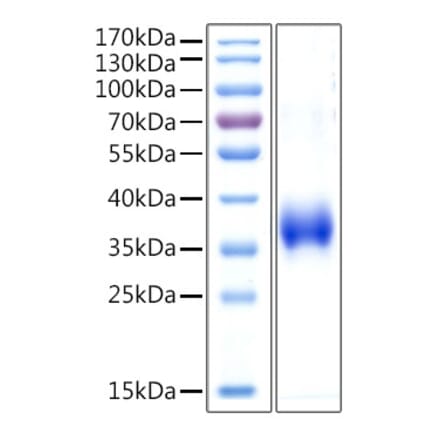 SDS-PAGE - Recombinant Human Cathepsin L Protein (C-terminal His Tag) (A330194) - Antibodies.com