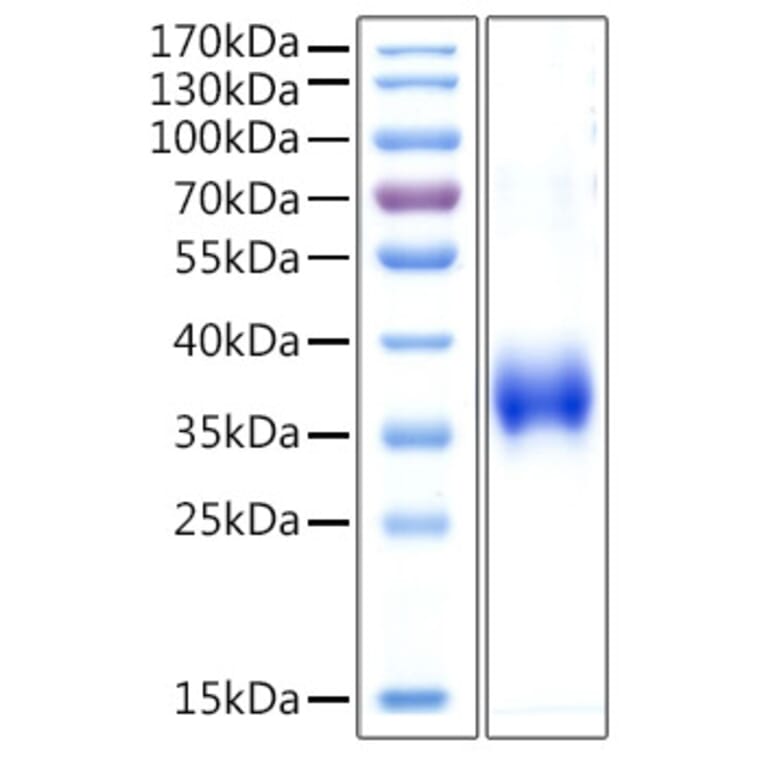 SDS-PAGE - Recombinant Human Cathepsin L Protein (C-terminal His Tag) (A330194) - Antibodies.com