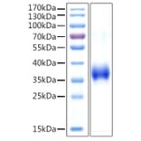SDS-PAGE - Recombinant Human Cathepsin L Protein (C-terminal His Tag) (A330194) - Antibodies.com