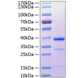 SDS-PAGE - Recombinant Human Cathepsin S Protein (C-terminal His Tag) (A330195) - Antibodies.com
