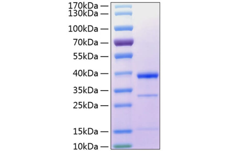 SDS-PAGE - Recombinant Human Cathepsin S Protein (C-terminal His Tag) (A330195) - Antibodies.com