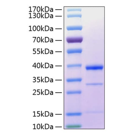 SDS-PAGE - Recombinant Human Cathepsin S Protein (C-terminal His Tag) (A330195) - Antibodies.com