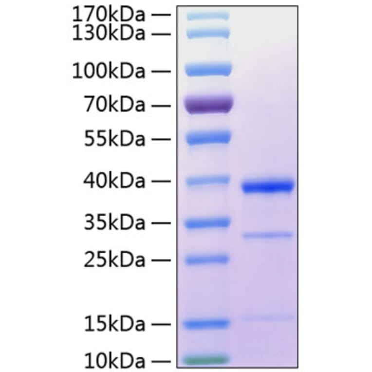 SDS-PAGE - Recombinant Human Cathepsin S Protein (C-terminal His Tag) (A330195) - Antibodies.com