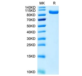 Tris-Bis PAGE - Recombinant Human CCK4 Protein (C-terminal His Tag) (A330196) - Antibodies.com