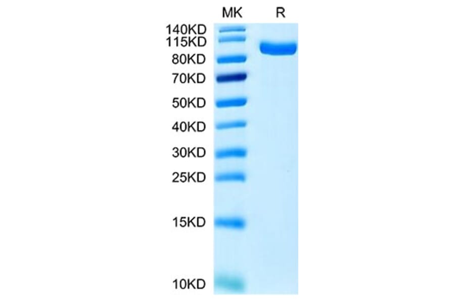 Tris-Bis PAGE - Recombinant Human CCK4 Protein (C-terminal His Tag) (A330196) - Antibodies.com