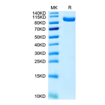 Tris-Bis PAGE - Recombinant Human CCK4 Protein (C-terminal His Tag) (A330196) - Antibodies.com
