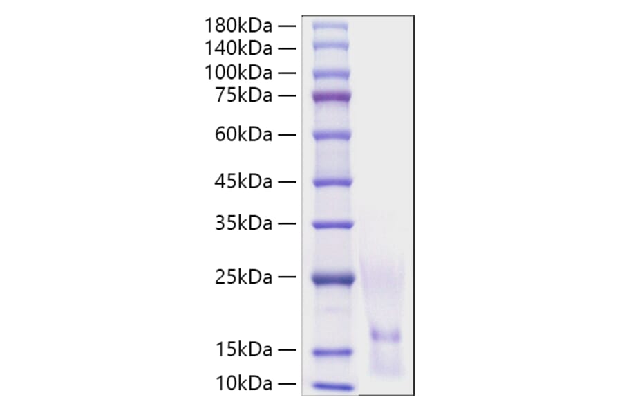 SDS-PAGE - Recombinant Human CCL1 Protein (A330197) - Antibodies.com