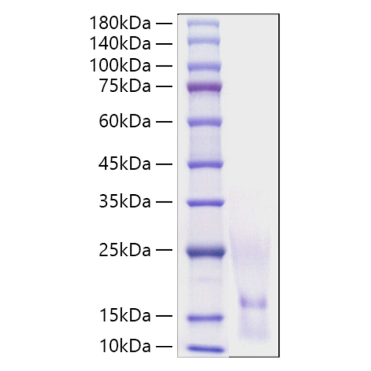 SDS-PAGE - Recombinant Human CCL1 Protein (A330197) - Antibodies.com